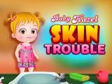 giocare Baby hazel skin trouble